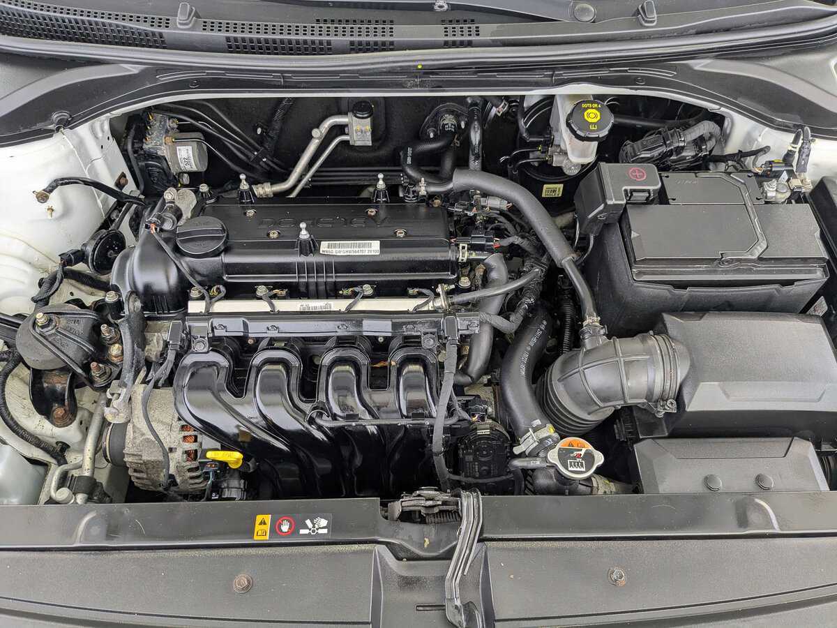 Hyundai Solaris 2017 года с пробегом. Фото: #8